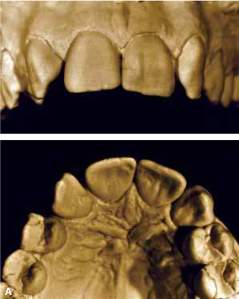 anomalie dentali