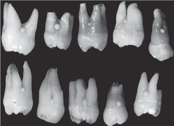 anomalie dentarie roma