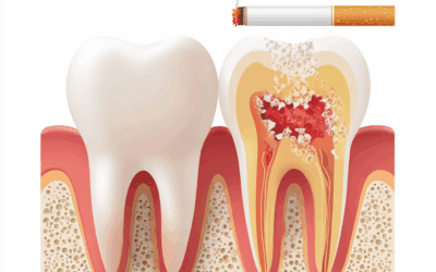 FUMO E PARODONTITE POSSIBILI RISCHI