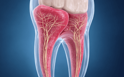 5 cose che devi sapere sul dente del giudizio